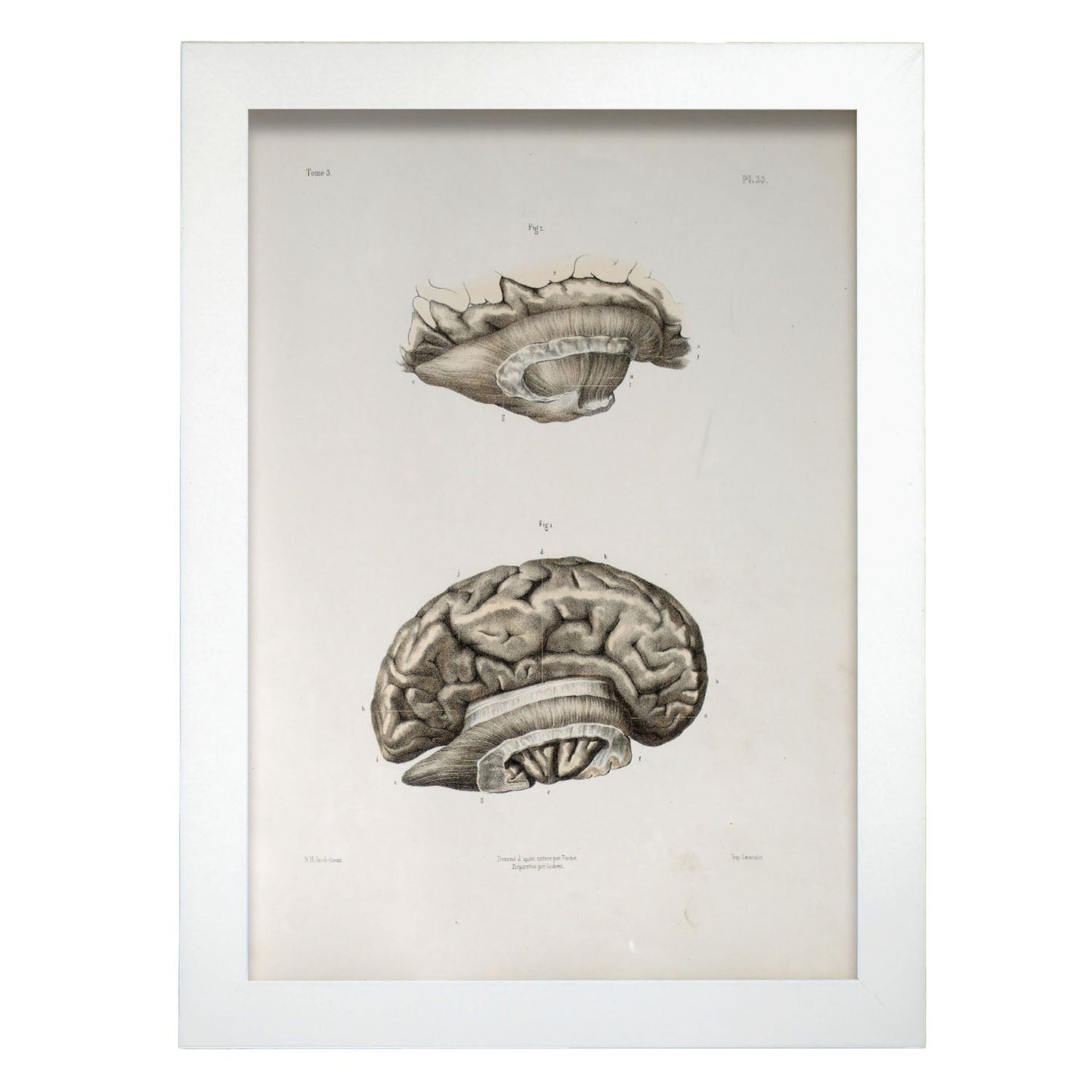 Brain divided in parasagital section-Artwork-Nacnic-A4-Marco Blanco-Nacnic Estudio SL