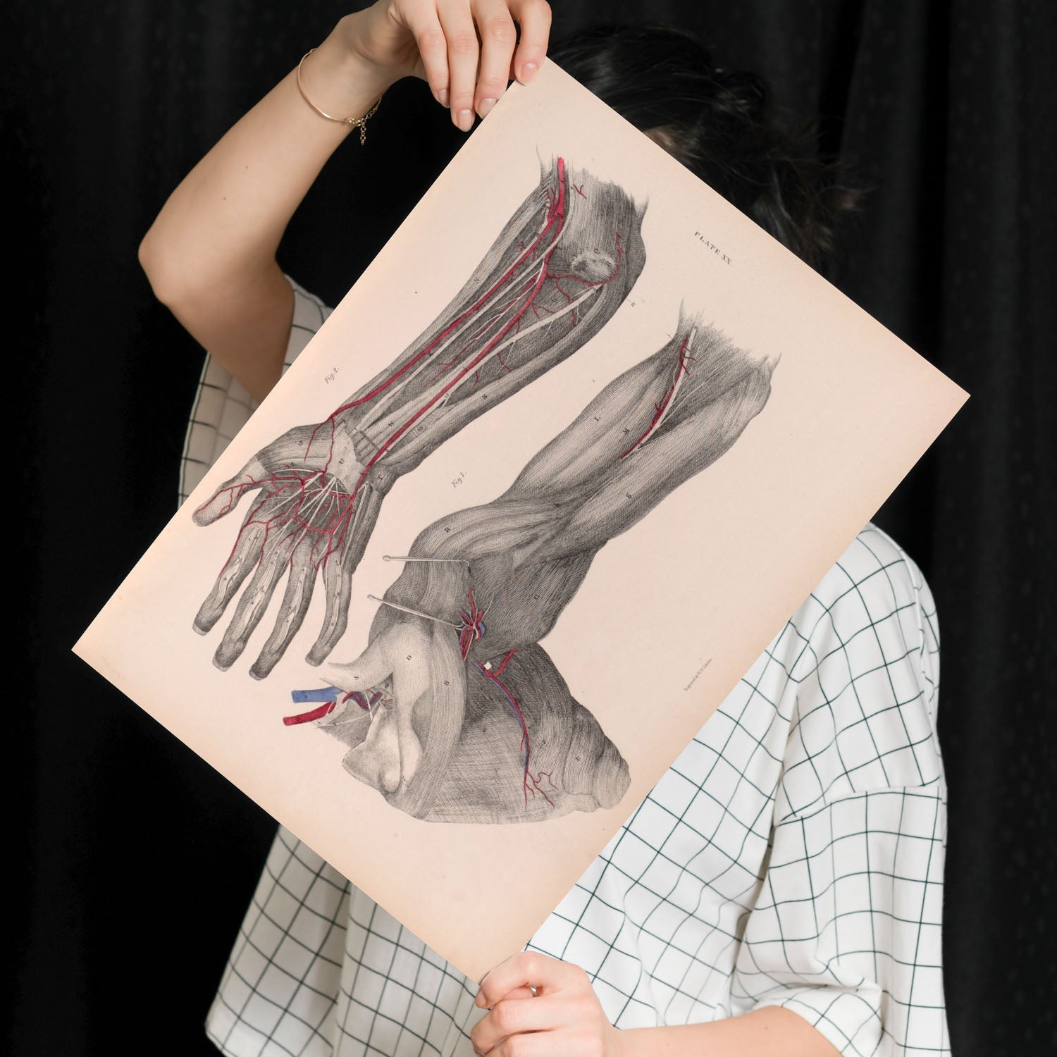 Dissection of the arm and hand-Artwork-Nacnic-Nacnic Estudio SL