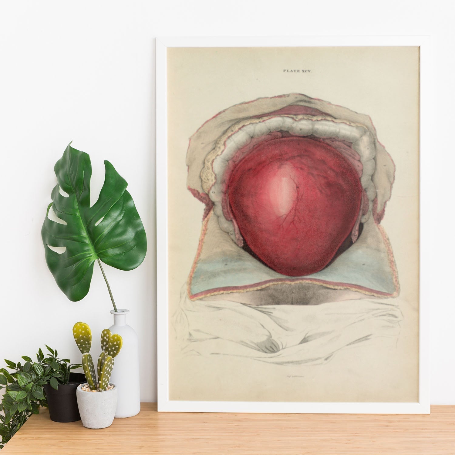 Gravid uterus-Artwork-Nacnic-Nacnic Estudio SL