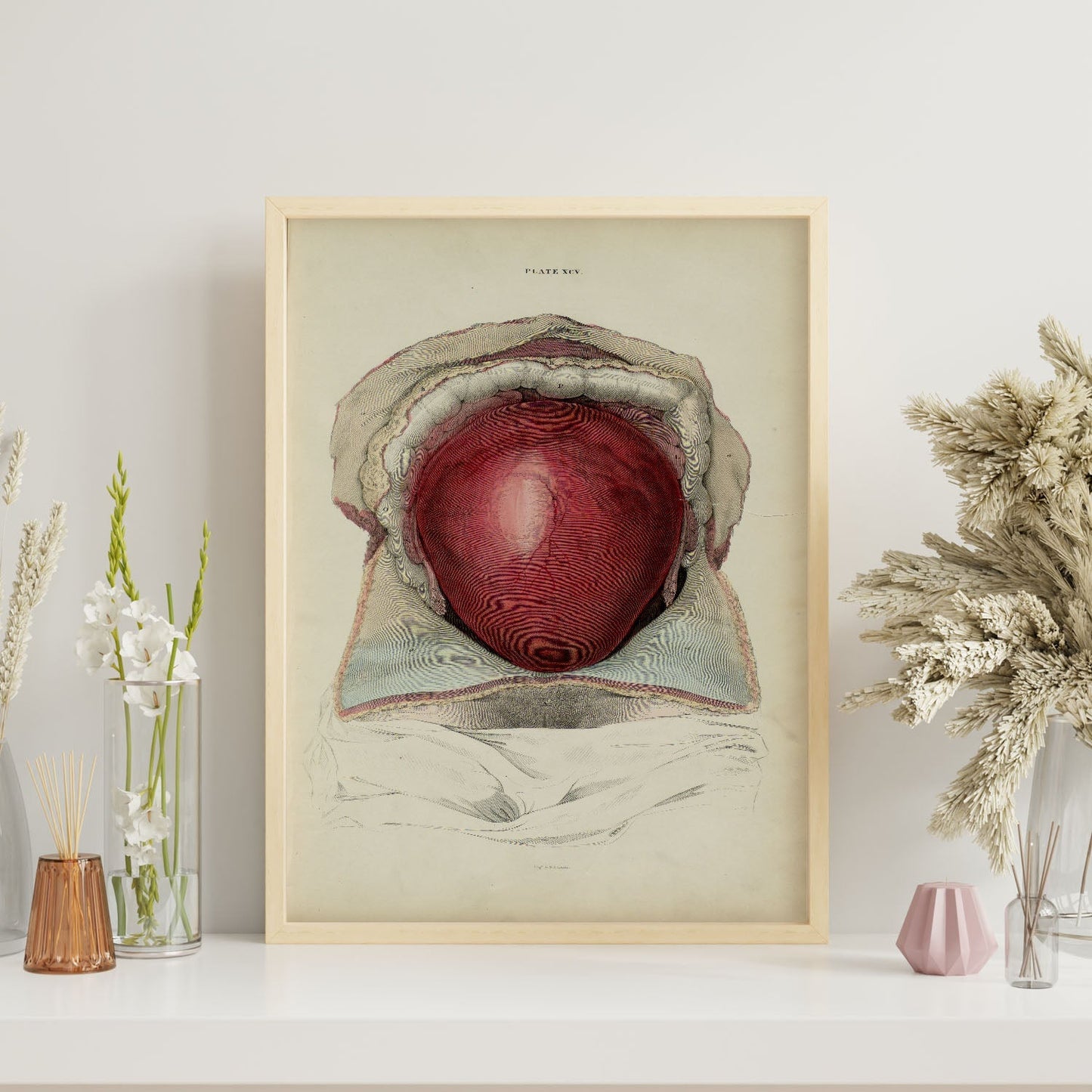 Gravid uterus-Artwork-Nacnic-Nacnic Estudio SL