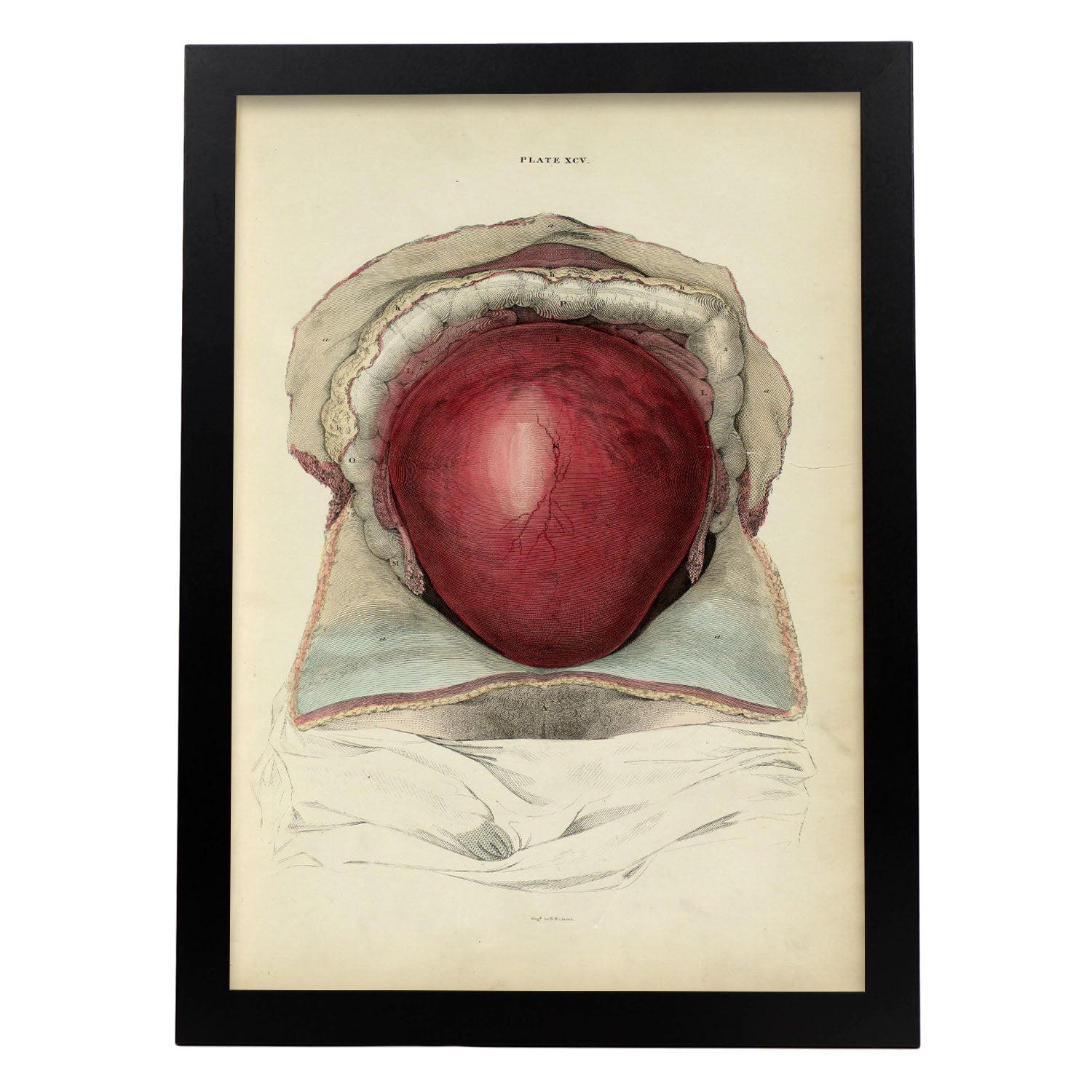Gravid uterus-Artwork-Nacnic-A3-Sin marco-Nacnic Estudio SL