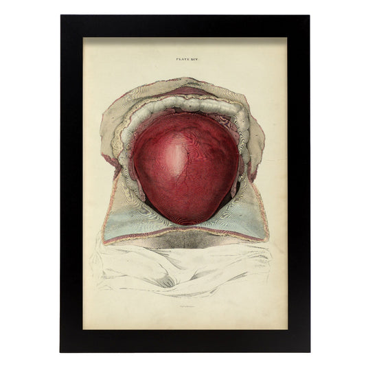 Gravid uterus-Artwork-Nacnic-A4-Sin marco-Nacnic Estudio SL