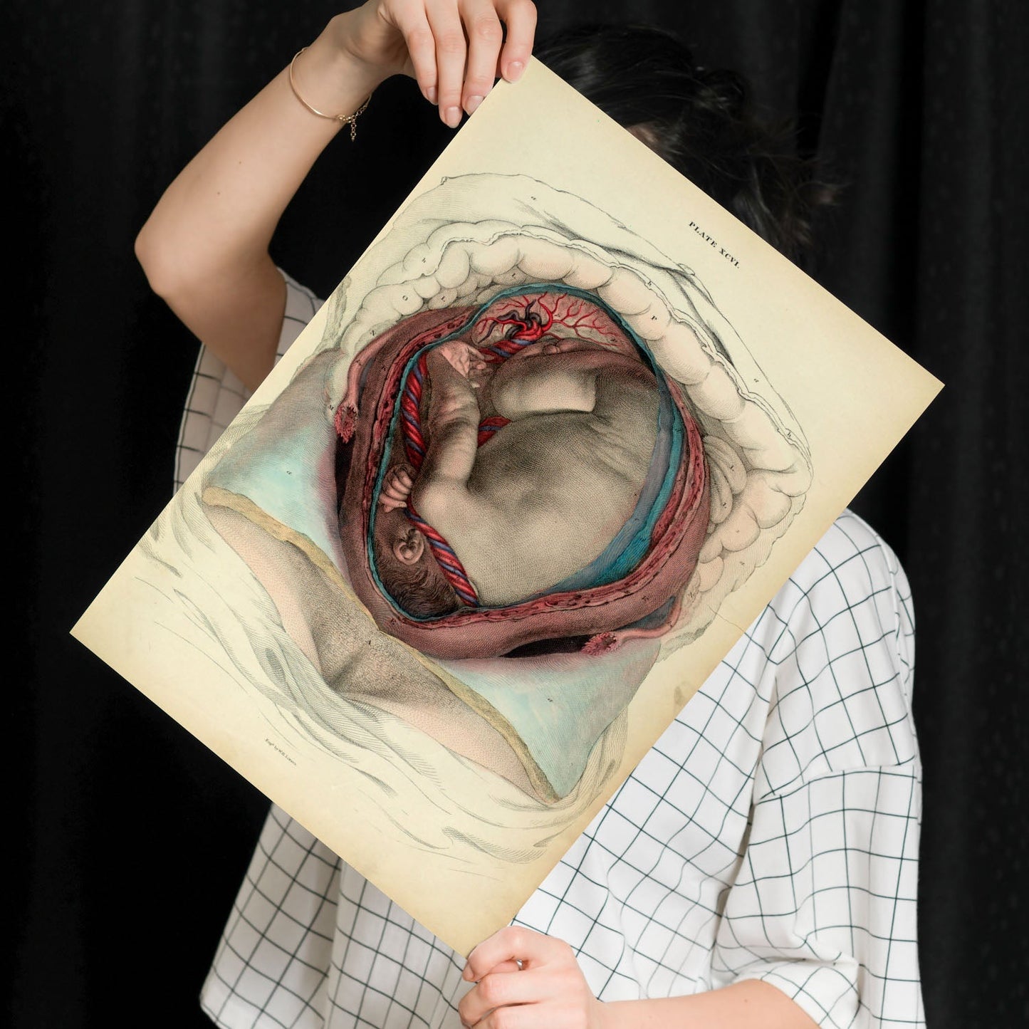 Gravid uterus with fetus-Artwork-Nacnic-Nacnic Estudio SL