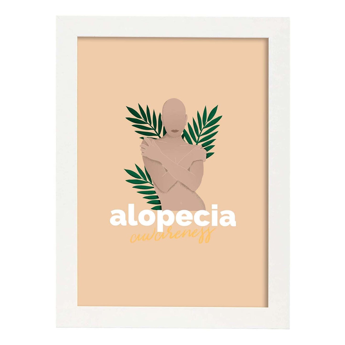 Lámina Alopecia. Pósters con ilustraciones sobre el amor propio y la aceptación.-Artwork-Nacnic-A3-Marco Blanco-Nacnic Estudio SL