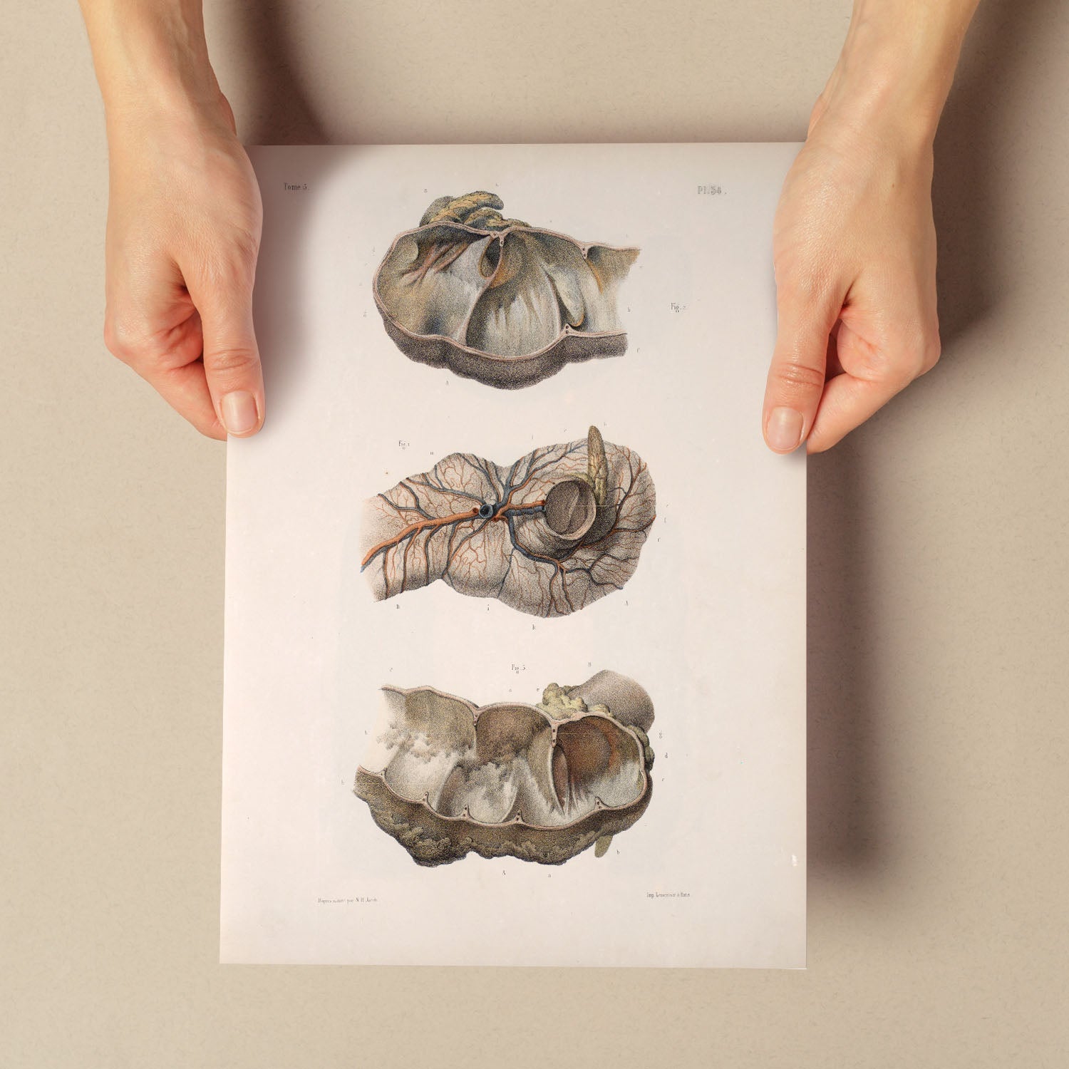 Large intestine; cecum and appendix-Artwork-Nacnic-Nacnic Estudio SL