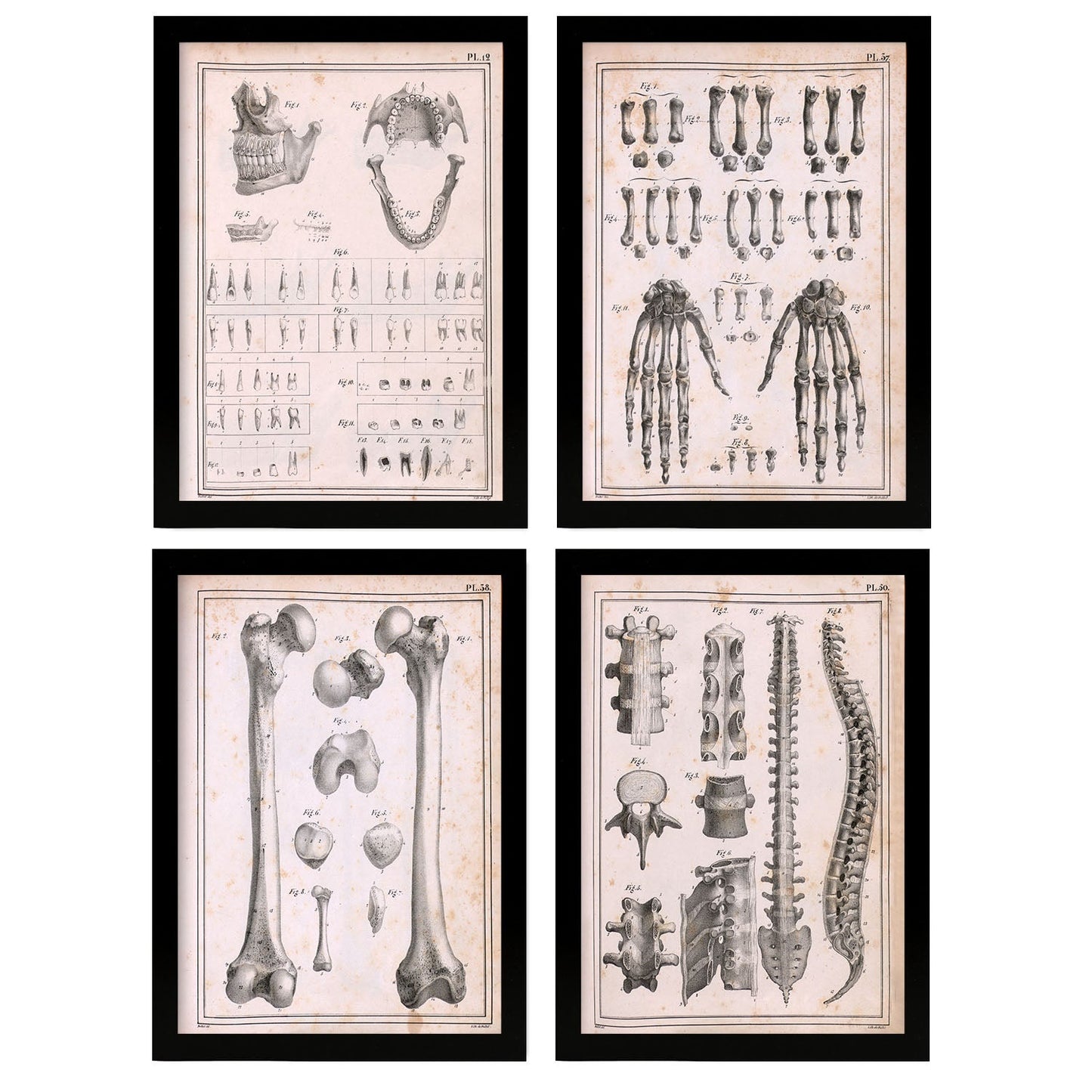 Nacnic Set of 4 Anatomy bones, hands, jaw and spine.-Artwork-Nacnic-Nacnic Estudio SL
