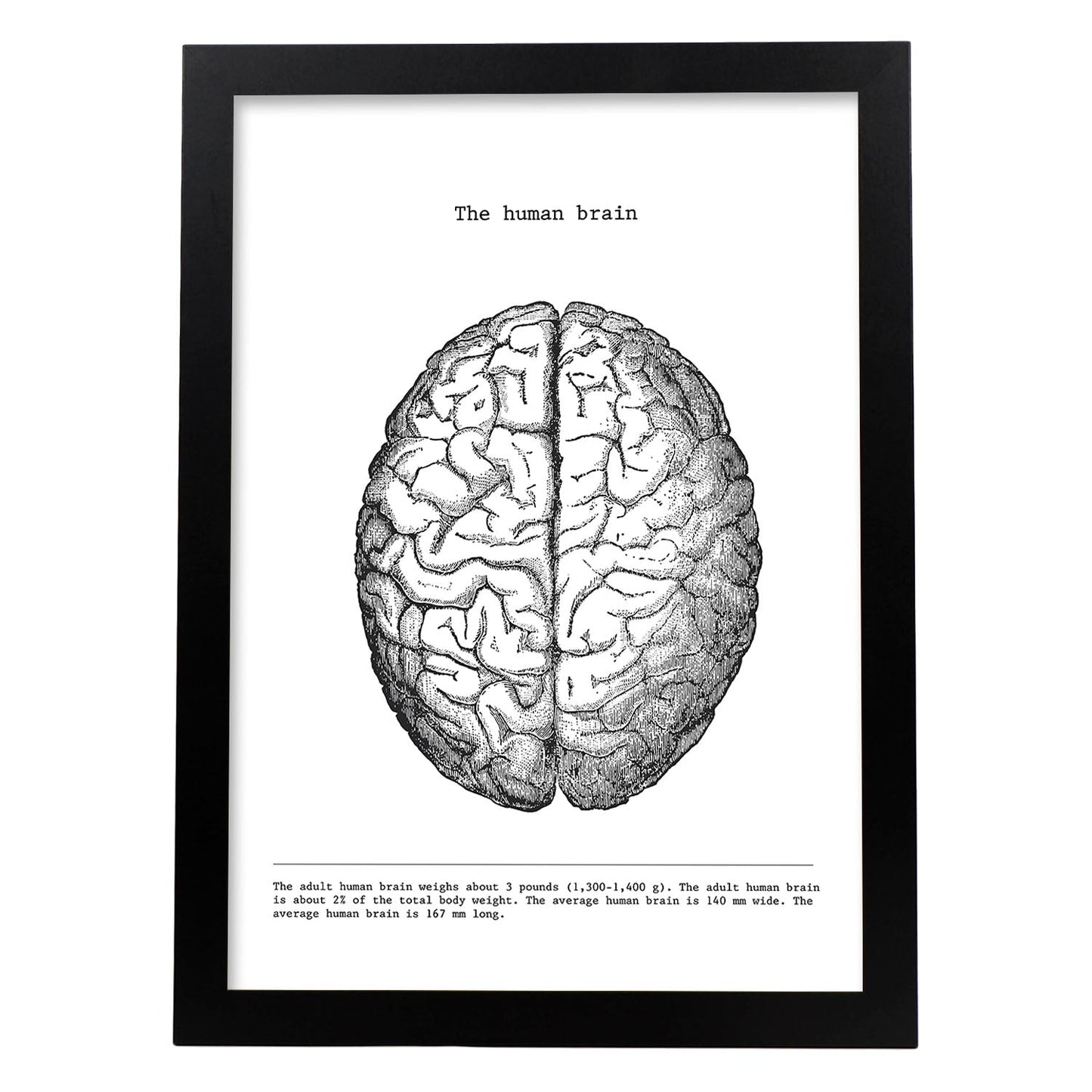 Posters de anatomía en blanco y negro con imágenes del cuerpo humano. Láminas de "Cerebro". .-Artwork-Nacnic-A3-Marco Negro-Nacnic Estudio SL